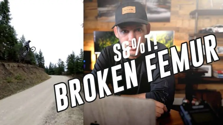 broken femur